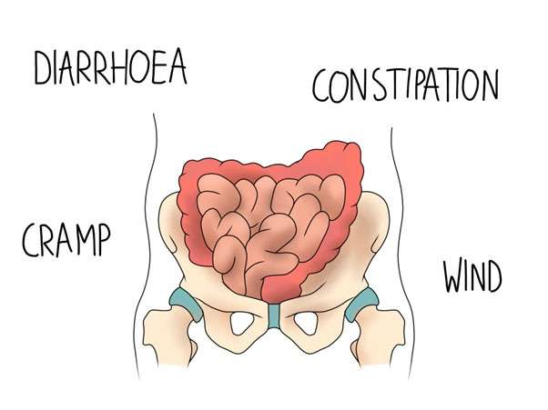 Managing IBS Flare-Ups